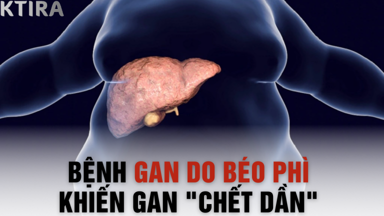 Bệnh Gan Do Béo Phì Khiến Gan “Chết Dần” – Chỉ Cần 3 Phút Đọc Bài Này, Bạn Sẽ Biết Cách Cứu Mình!