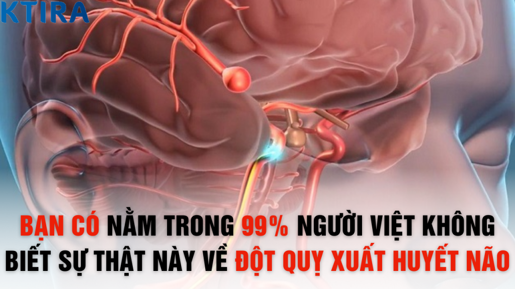 99% Người Việt Không Biết Sự Thật Này Về Đột Quỵ Xuất Huyết Não