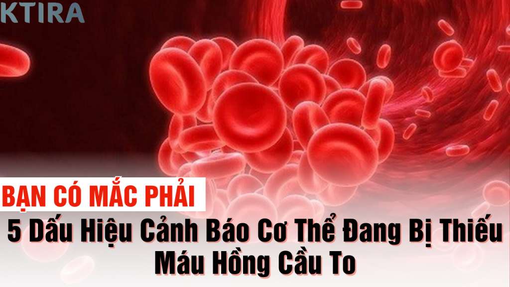 Đừng Bỏ Qua! 5 Dấu Hiệu Cảnh Báo Cơ Thể Đang Bị Thiếu Máu Hồng Cầu To