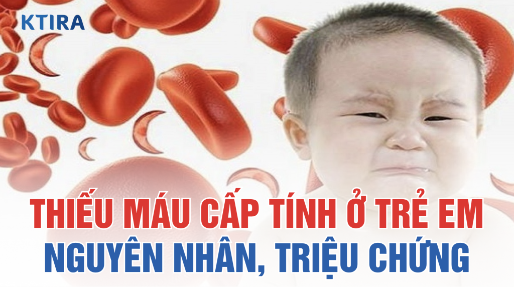 Thiếu máu cấp tính ở trẻ em ktira