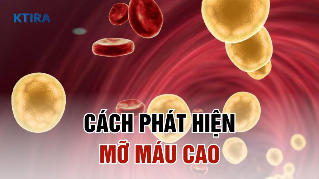Cách phát hiện mỡ máu cao