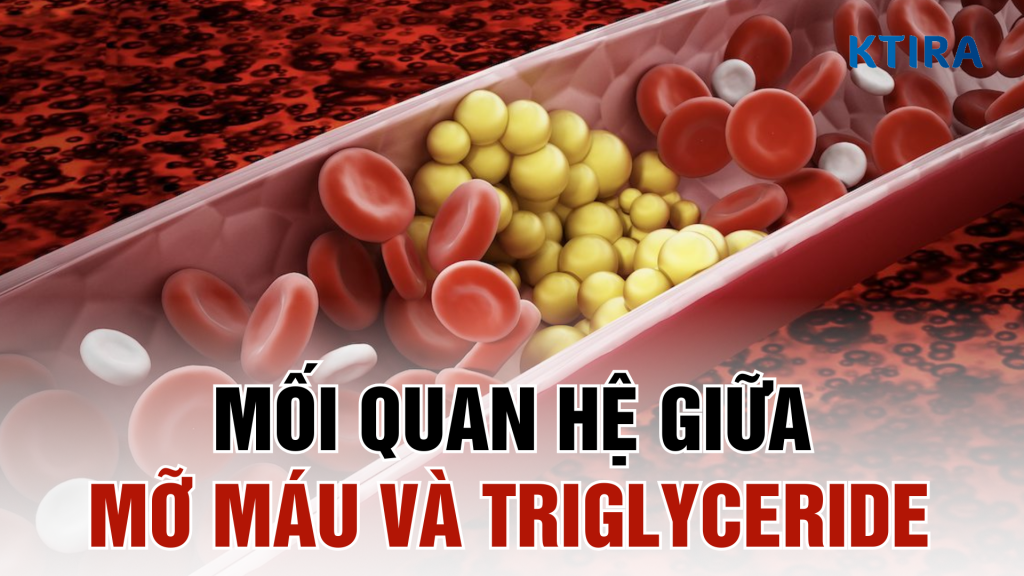 Mối liên hệ giữa mỡ máu và chỉ số triglyceride
