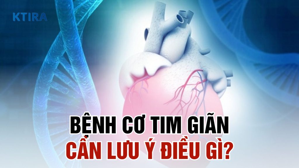 Bệnh cơ tim giãn và cách phòng ngừa
