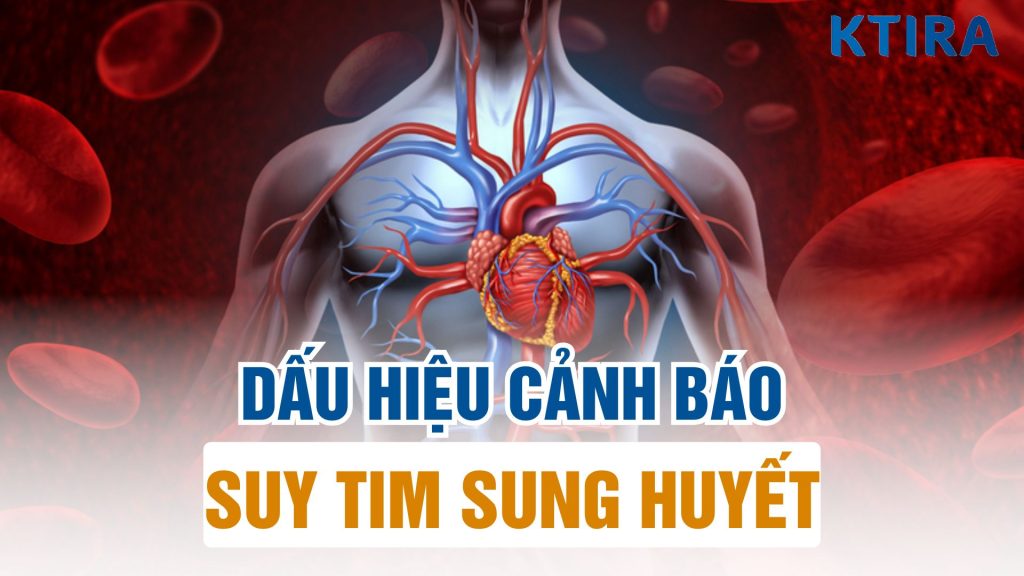 Dấu hiệu suy tim sung huyết