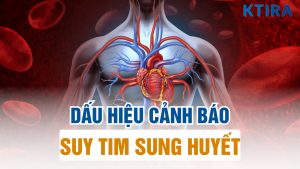 Dấu hiệu suy tim sung huyết