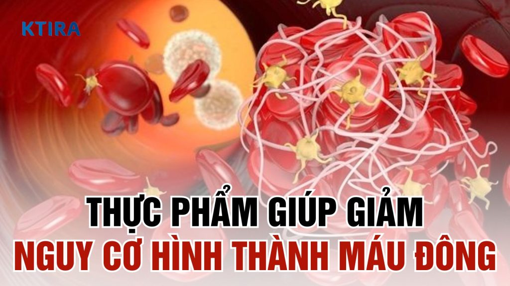 Giảm nguy cơ hình thành cục máu đông