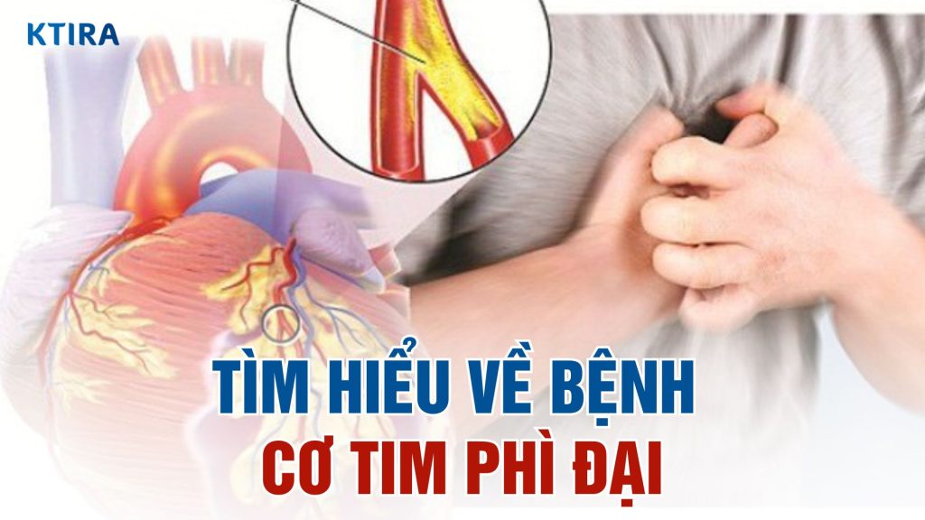 Bệnh cơ tim phì đại