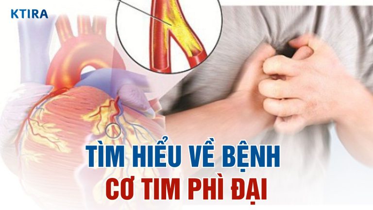 Bệnh Cơ Tim Phì Đại: Triệu Chứng, 3 Nguyên Nhân và Phương Pháp Điều Trị
