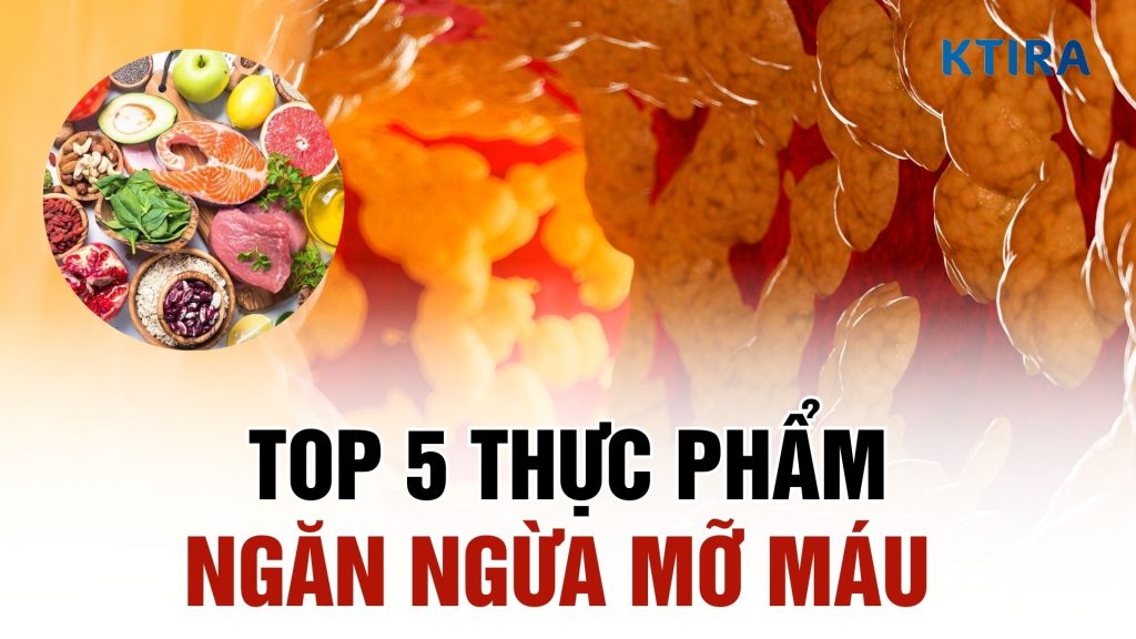 Thực phẩm ngăn ngừa mỡ máu