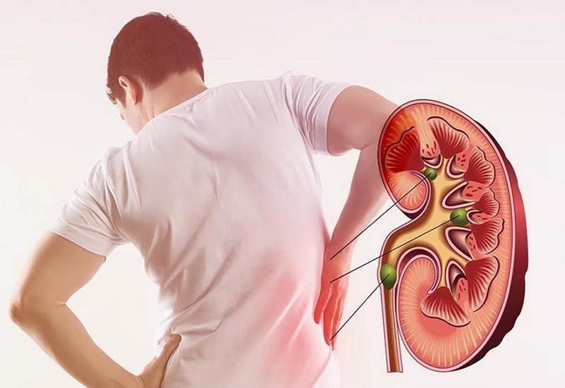 Ngăn ngừa bệnh thận mạn tính