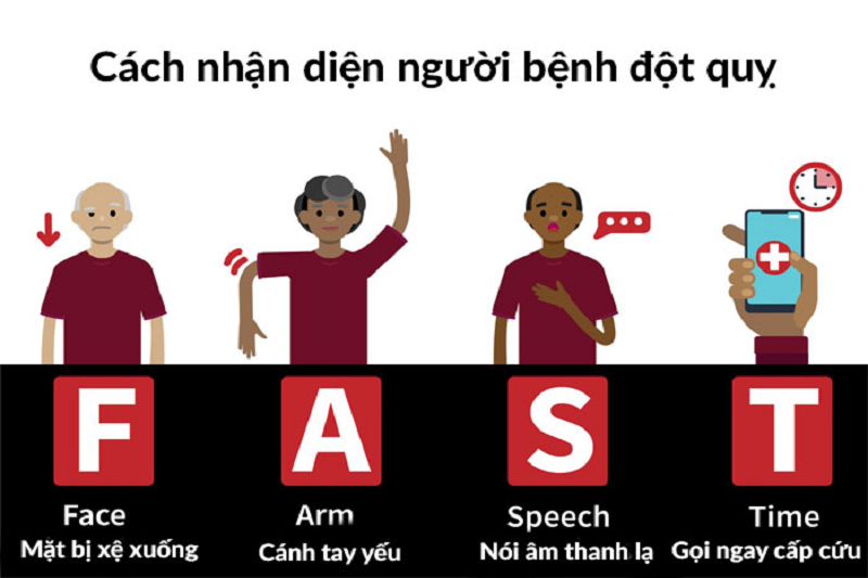 Cách nhận biết đột quỵ kịp thời