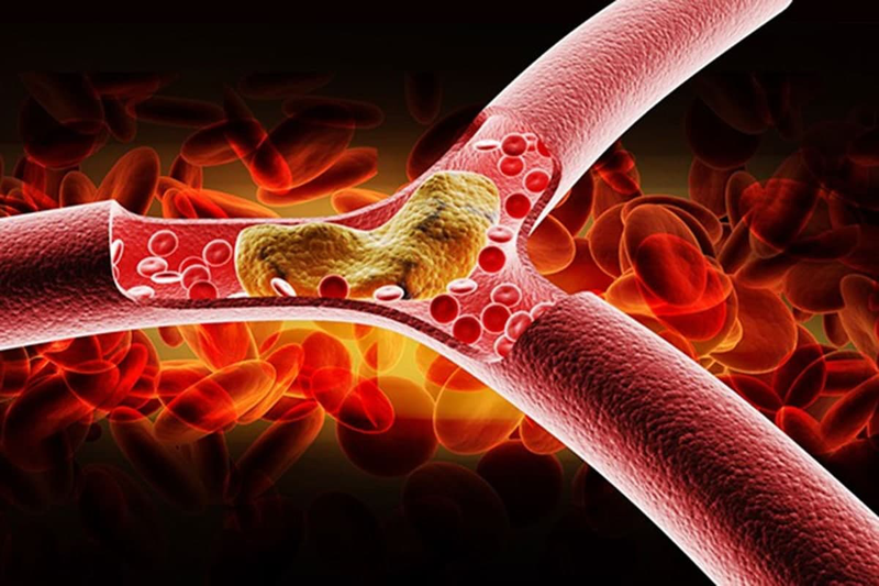 Cholesterol là gì?
