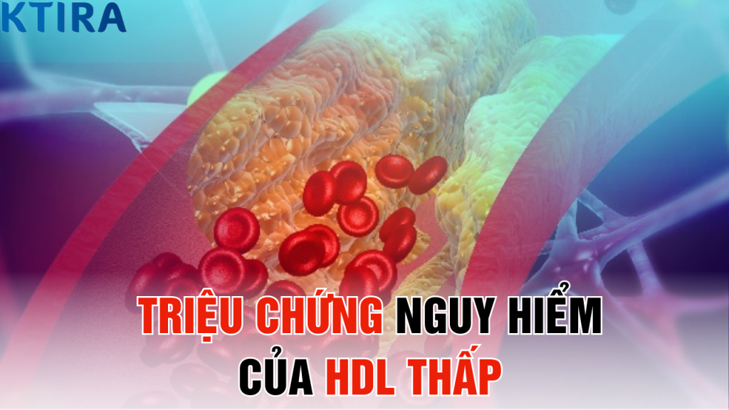 Dấu Hiệu HDL Thấp: 5 triệu chứng nguy hiểm mà bạn không biết