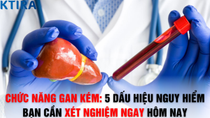 Chức Năng Gan Kém: 5 Dấu Hiệu Nguy Hiểm Bạn Cần Xét Nghiệm Ngay Hôm Nay