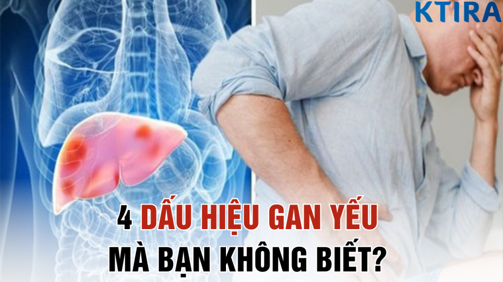 4 Dấu hiệu Gan yếu mà Bạn không biết?