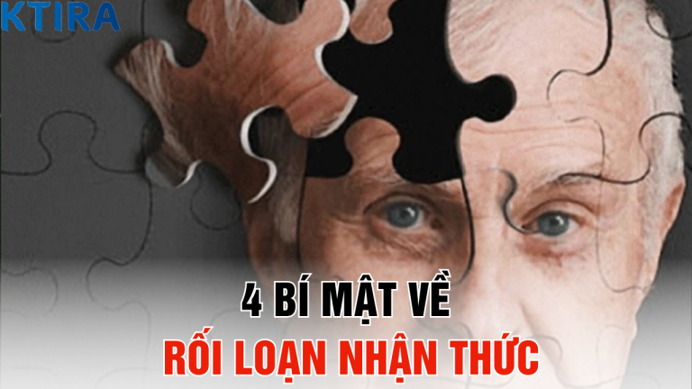 Triệu Chứng Rối Loạn Nhận Thức: 4 Bí Mật Mà Não Bộ Bạn Không Muốn Bạn Biết!
