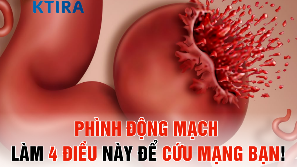 Phình Động Mạch: Làm 4 Điều Này Ngay Hôm Nay Để Cứu Mạng Bạn!