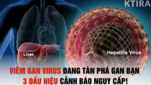Viêm Gan Virus Đang Lặng Lẽ Tàn Phá Gan Bạn – 3 Dấu Hiệu Cảnh Báo Nguy Cấp!