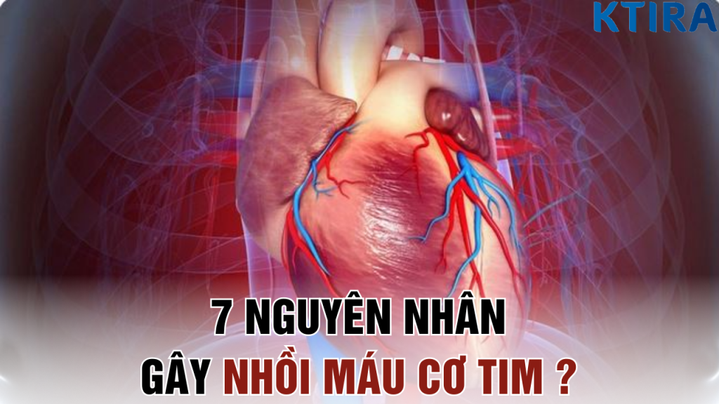 7 Nguyên Nhân Gây Nhồi Máu Cơ TIM ?