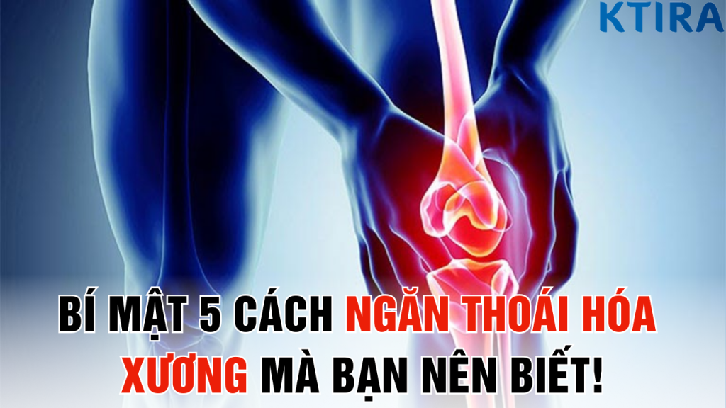 Bí Mật 5 Cách Ngăn Thoái Hóa Xương Mà Bạn Nên Biết!