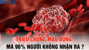 Triệu chứng máu đông xuất hiện mà 90% người không nhận ra – Bạn có nằm trong số đó?