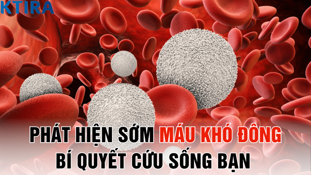 Phát Hiện Sớm Máu Khó Đông: Bí Quyết Cứu Sống Bạn Chỉ Trong 1 Phút