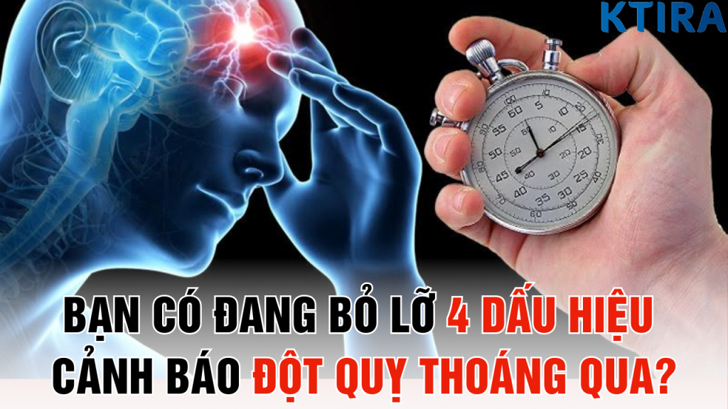 Bạn có đang bỏ lỡ 4 dấu hiệu cảnh báo đột quỵ thoáng qua?