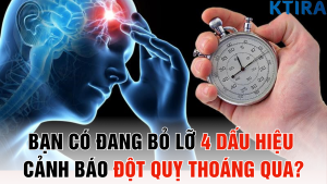 Bạn có đang bỏ lỡ 4 dấu hiệu cảnh báo đột quỵ thoáng qua?