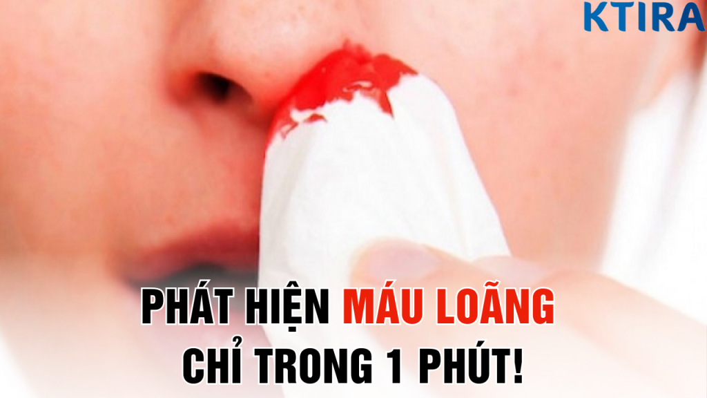 Phát Hiện Máu Loãng Chỉ Trong 1 Phút: Bạn Sẽ Hối Hận Nếu Không Biết Sớm!