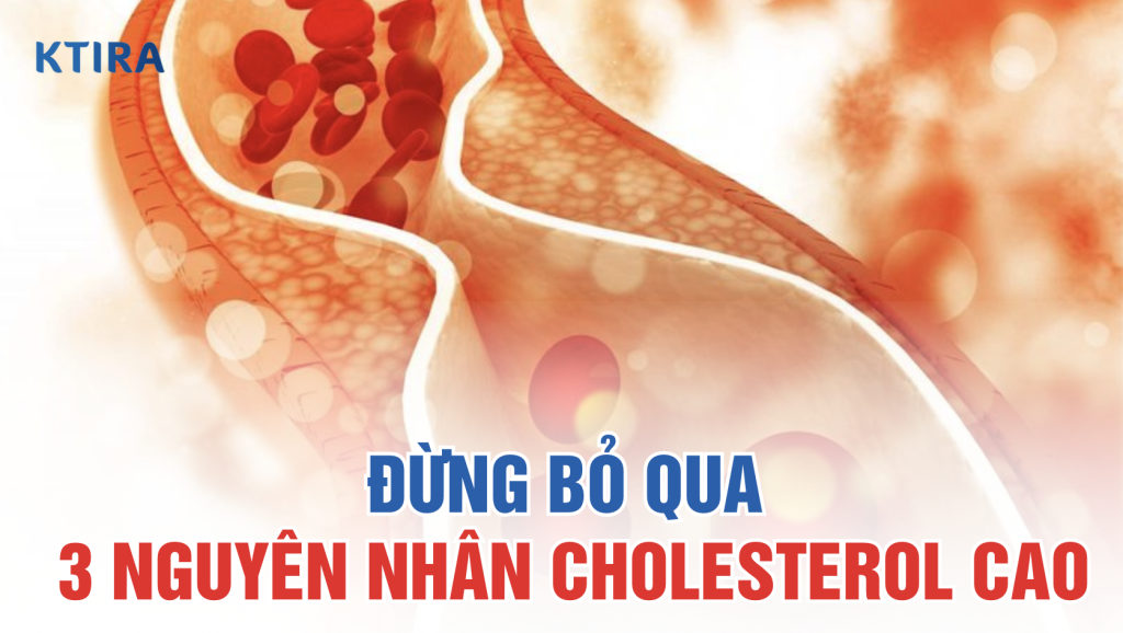 Nguyên nhân cholesterol cao KTIRA