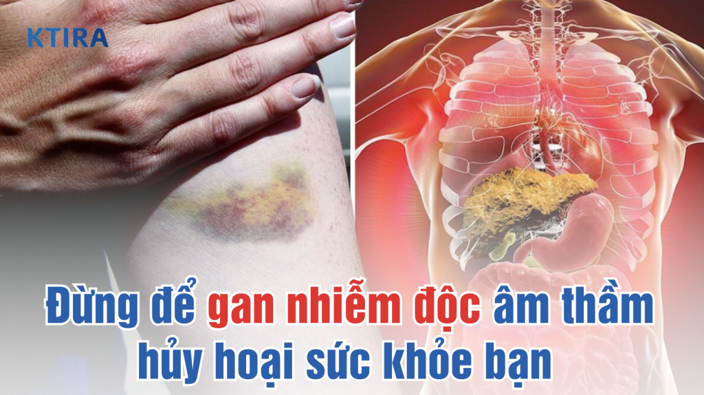 gan nhiễm độc ktira