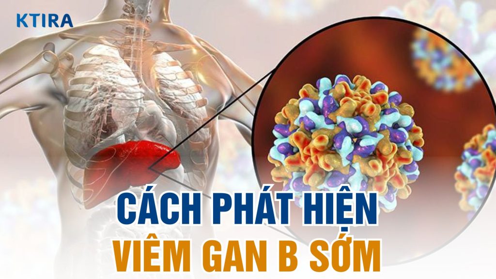 3 cách phát hiện viêm gan B sớm