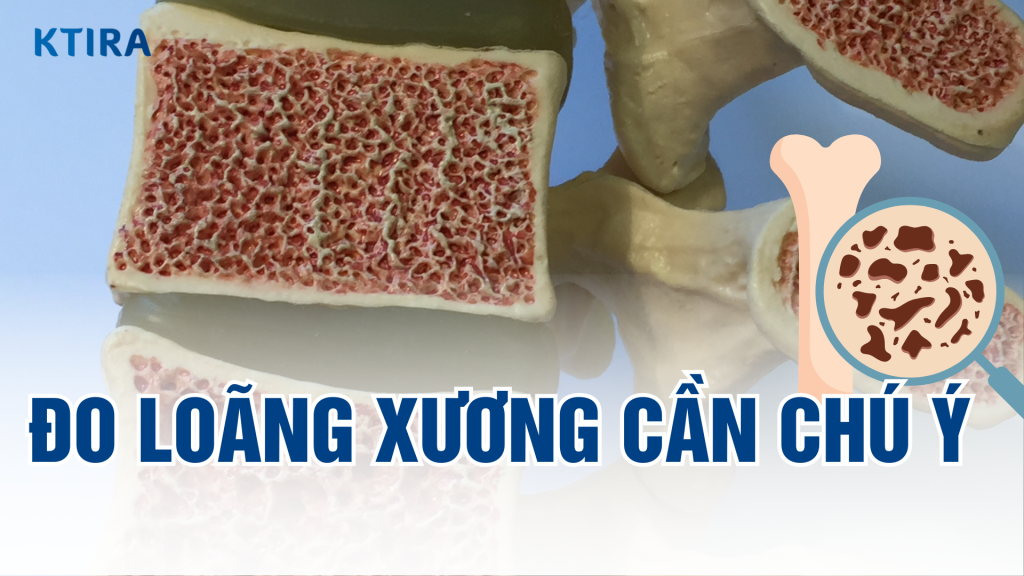 Điều quan trọng về đo loãng xương