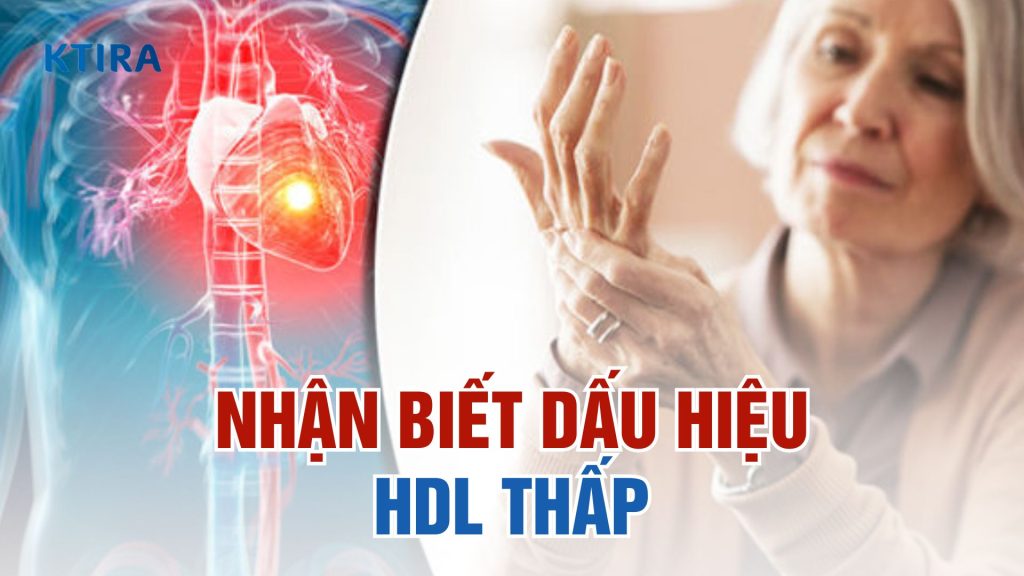 Dấu hiệu HDL thấp