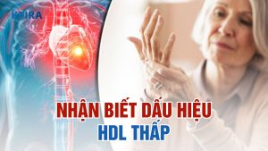 Dấu hiệu HDL thấp