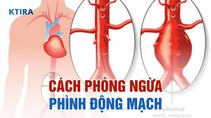 Cách phòng ngừa phình động mạch