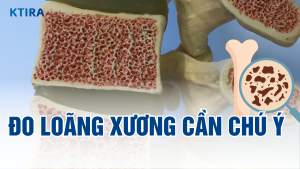 Điều quan trọng về đo loãng xương