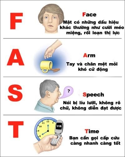 Dấu hiệu đột quỵ -bạn đã biết chưa ?