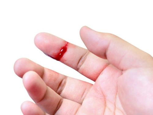Triệu chứng của việc khó đông ở máu