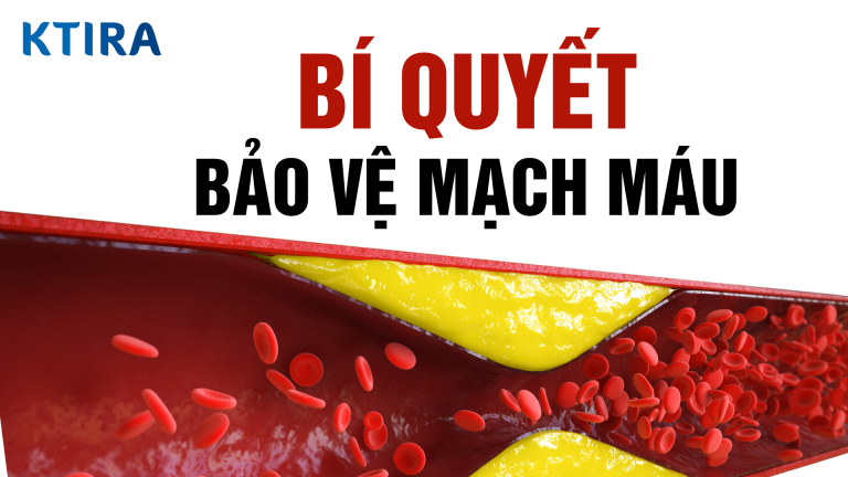 4 Bí Quyết Bảo Vệ Mạch Máu Mỗi Ngày Giúp Bạn Sống Khỏe Hơn