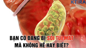bạn có đang bị sỏi túi mật mà không hề hay biết?