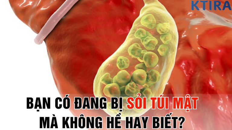 Sỏi Túi Mật: Dấu Hiệu Bí Mật Mà 90% Người Bệnh Không Nhận Ra – Bạn Có Nằm Trong Số Đó?