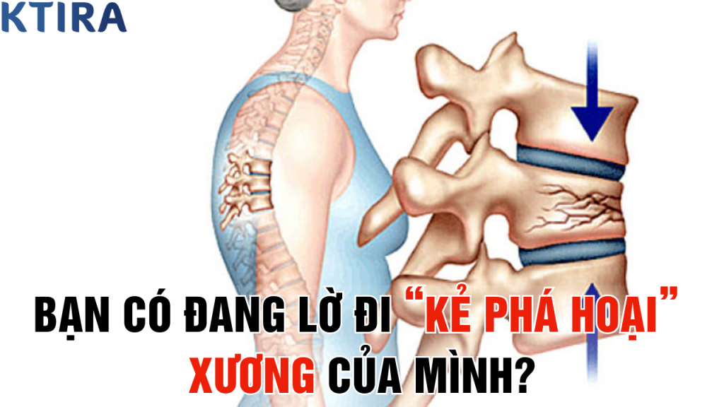 Đừng Chờ Đến Khi Gãy Xương Do Loãng Xương