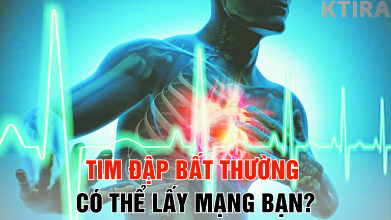 Tim Đập Bất Thường Có Thể Lấy Mạng Bạn – 3 Thay Đổi Nhỏ Cứu Tim Ngay Hôm Nay!
