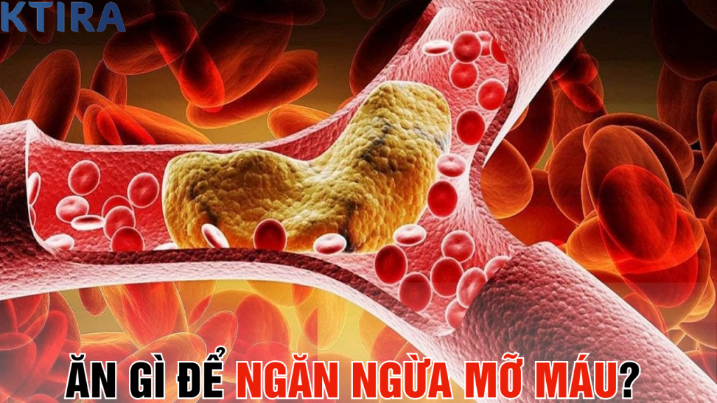 Ăn Gì Để Ngăn Ngừa Mỡ Máu? 5 Loại Thực Phẩm Này Có Thể Cứu Sống Bạn!