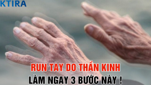 Run tay do thần kinh: Làm ngay 3 bước này trước khi quá muộn!