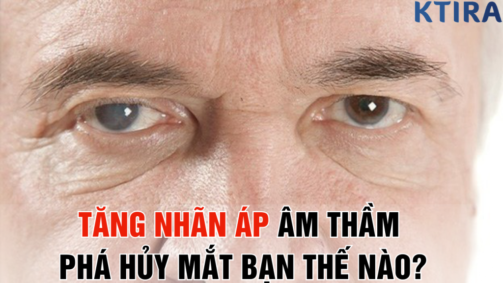 Tăng nhãn áp âm thầm phá hủy mắt BẠN thế nào?