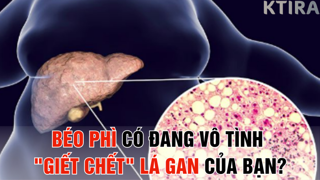 Ngừa Gan Nhiễm Mỡ Hay Chết Sớm Vì Béo Phì?