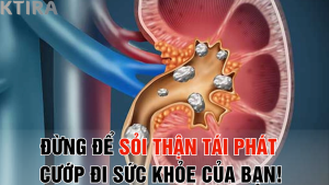 Đừng để sỏi thận tái phát cướp đi sức khỏe của bạn!