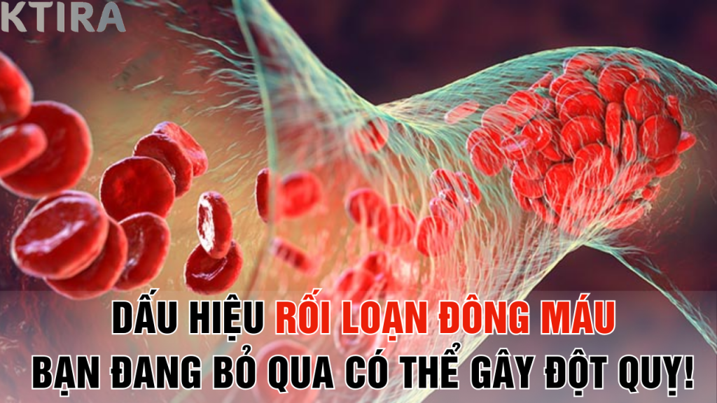 Dấu Hiệu Rối Loạn Đông Máu Bạn Đang Bỏ Qua Có Thể Gây Đột Quỵ!